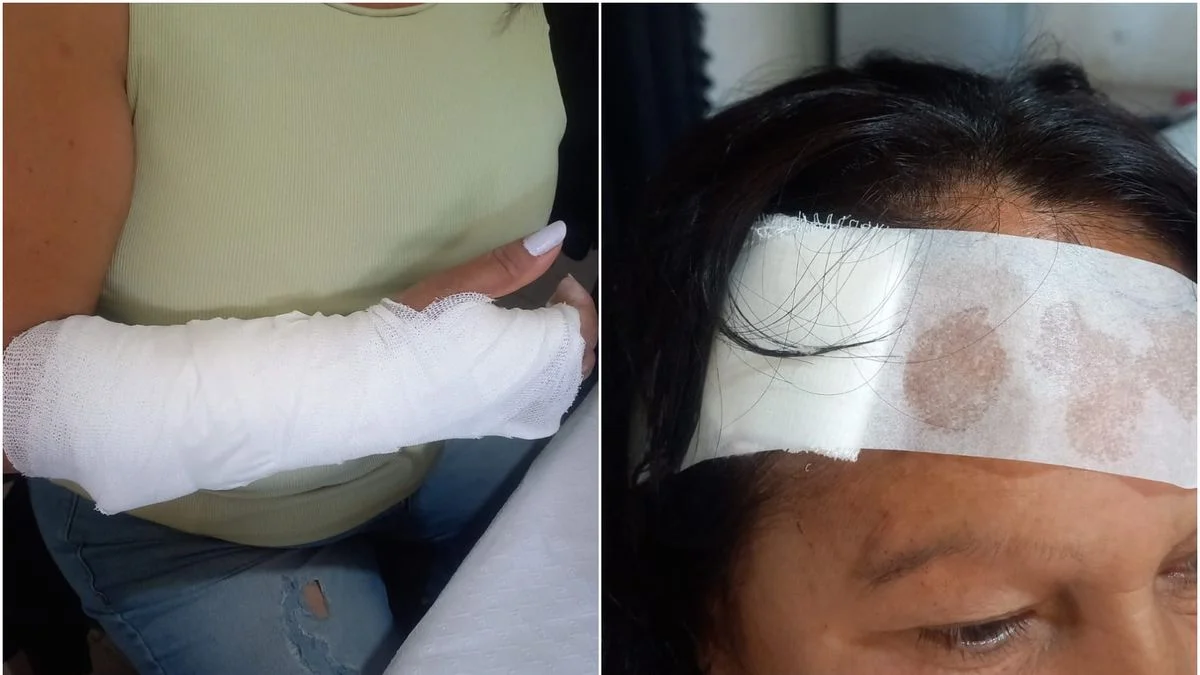 Delincuentes salvajes le abrieron la cabeza a una vecina para robarle la cartera