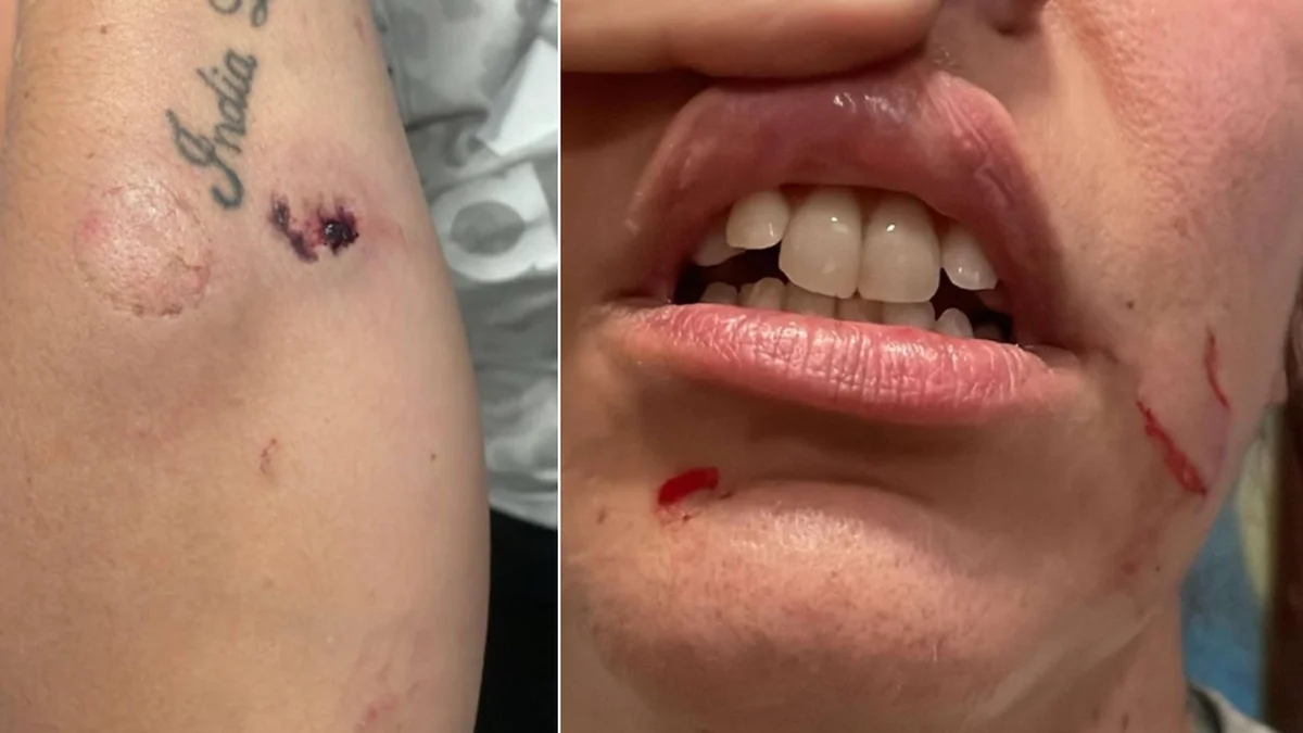 Brutal ataque a una joven en pleno centro de Ensenada