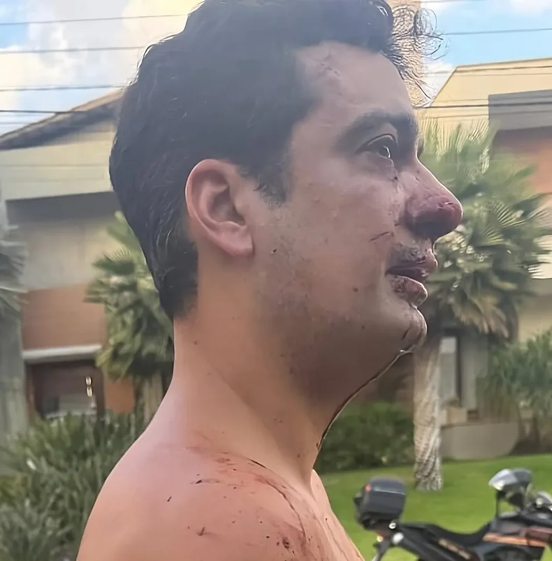 As&iacute; qued&oacute; el vecino del ex Estudiantes, Eros Mancuso tras la pelea en Brasil