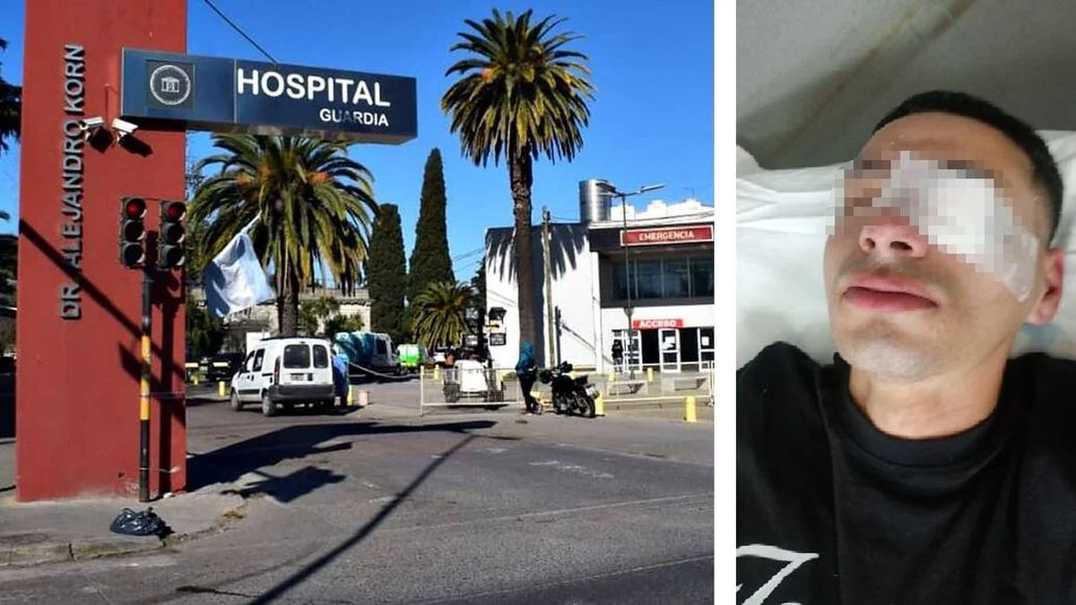 San Carlos: le pegaron un tiro, fue al hospital y terminó preso