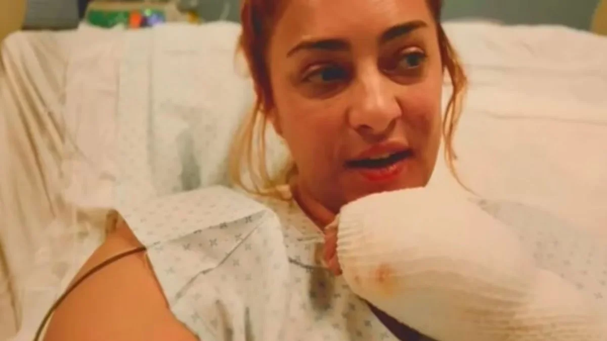 María Julia Oliván mostró las cicatrices que le quedaron tras sufrir un accidente doméstico