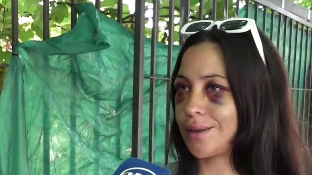 La mujer golpeada en el centro de La Plata contó como fue el ataque brutal