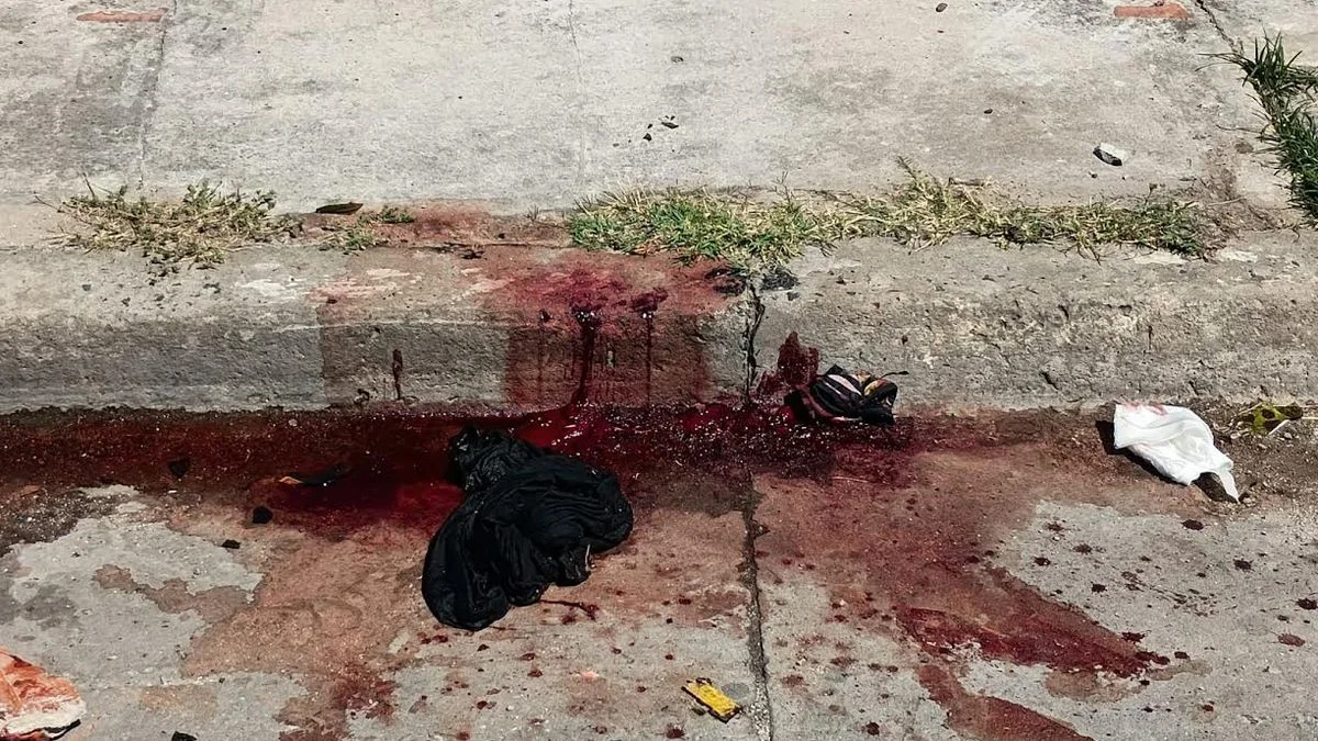 Sangrienta pelea en Berisso: un herido grave y un detenido