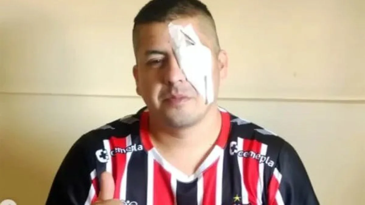 Un hombre perdió un ojo durante la represión y denunció a Patricia Bullrich