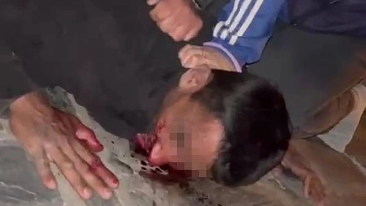 Vecinos de San Carlos le dieron una paliza a un ladrón