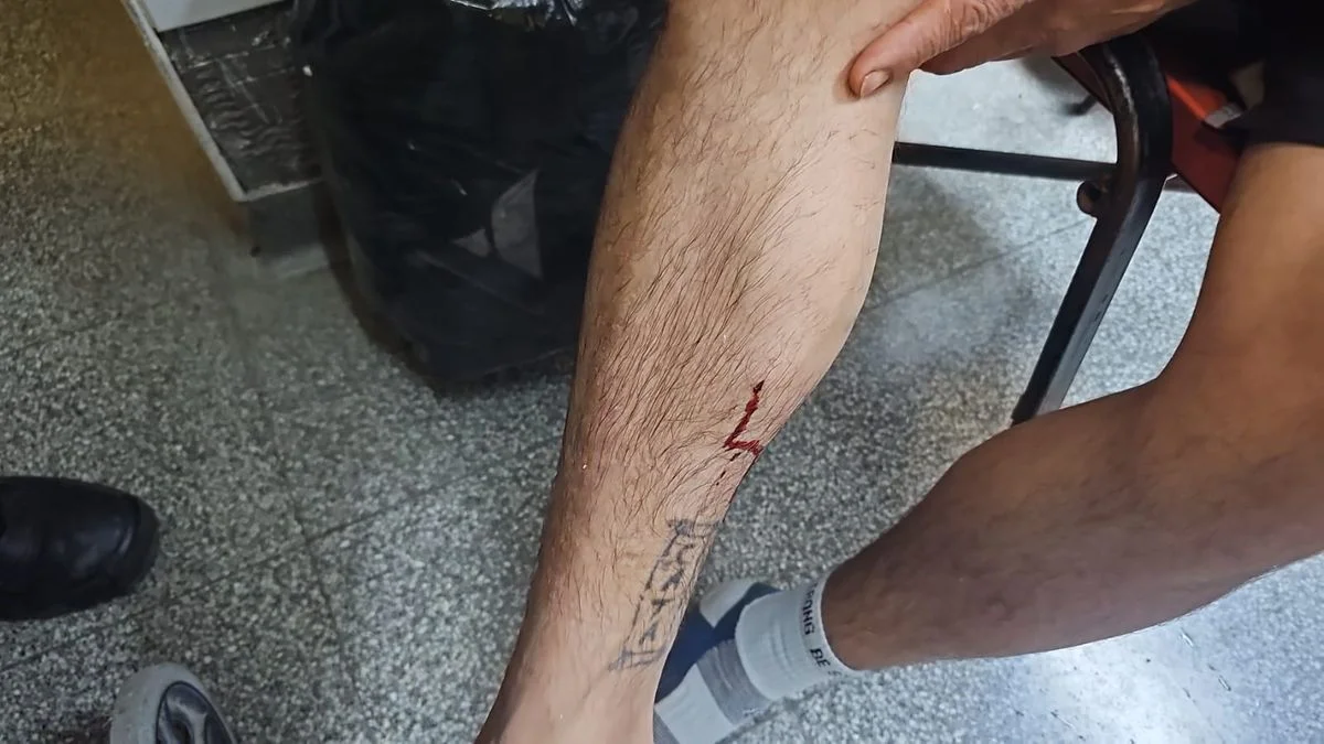 Lo balearon para robarle la moto en Villa Elisa