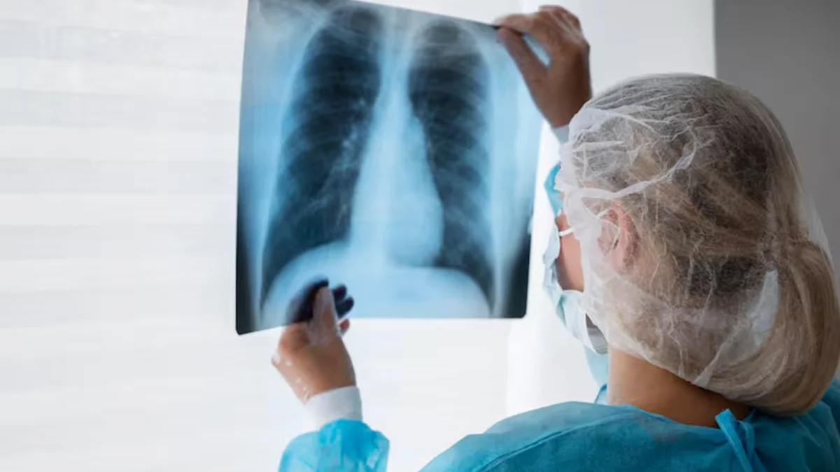 Alerta por el crecimiento de casos de tuberculosis en Argentina
