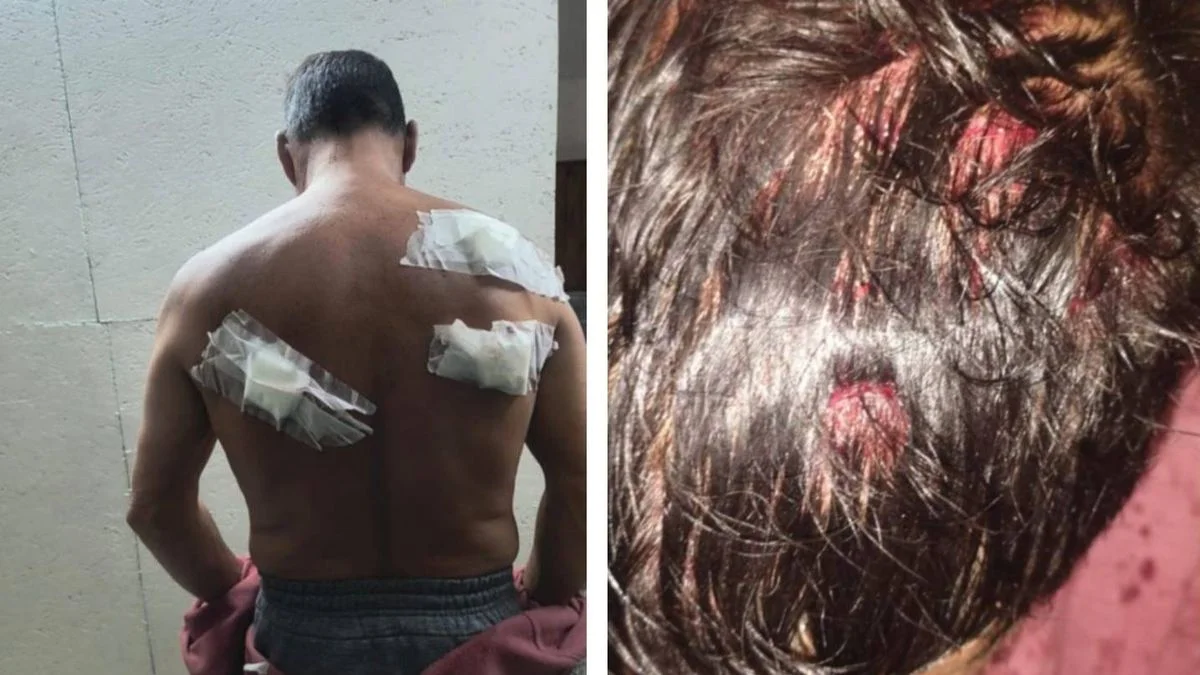 Violencia en Tolosa: quiso matar a cuchillazos al novio de su ex