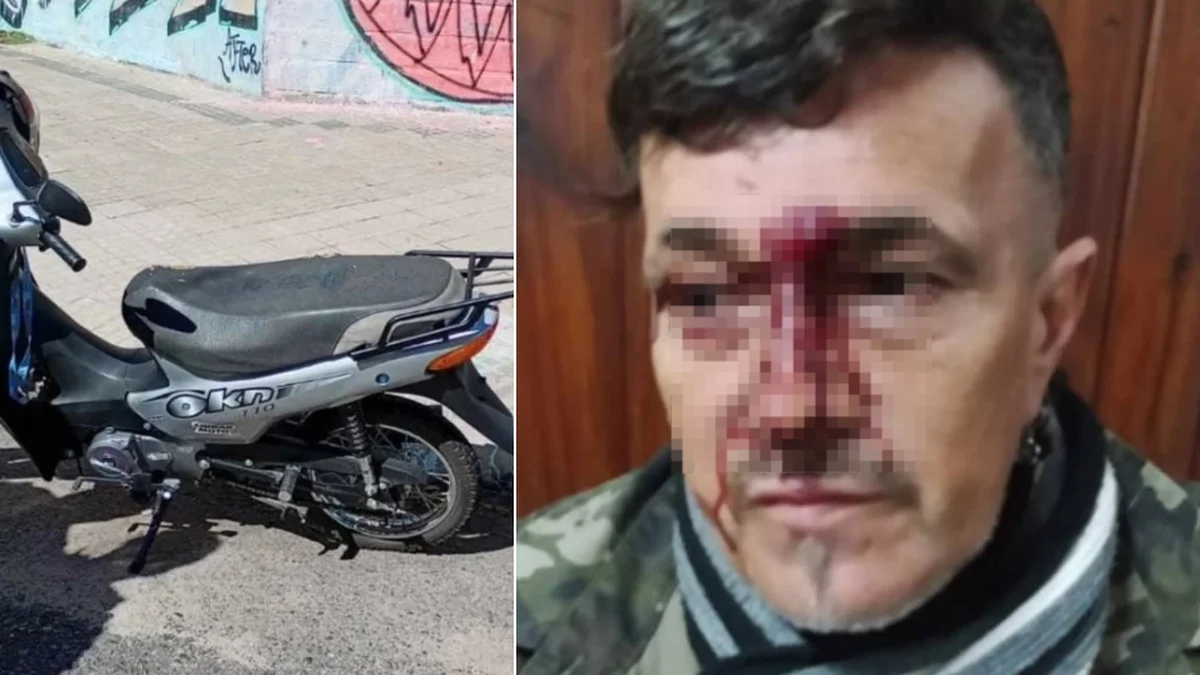 Brutal golpiza a un hombre para robarle en Tolosa