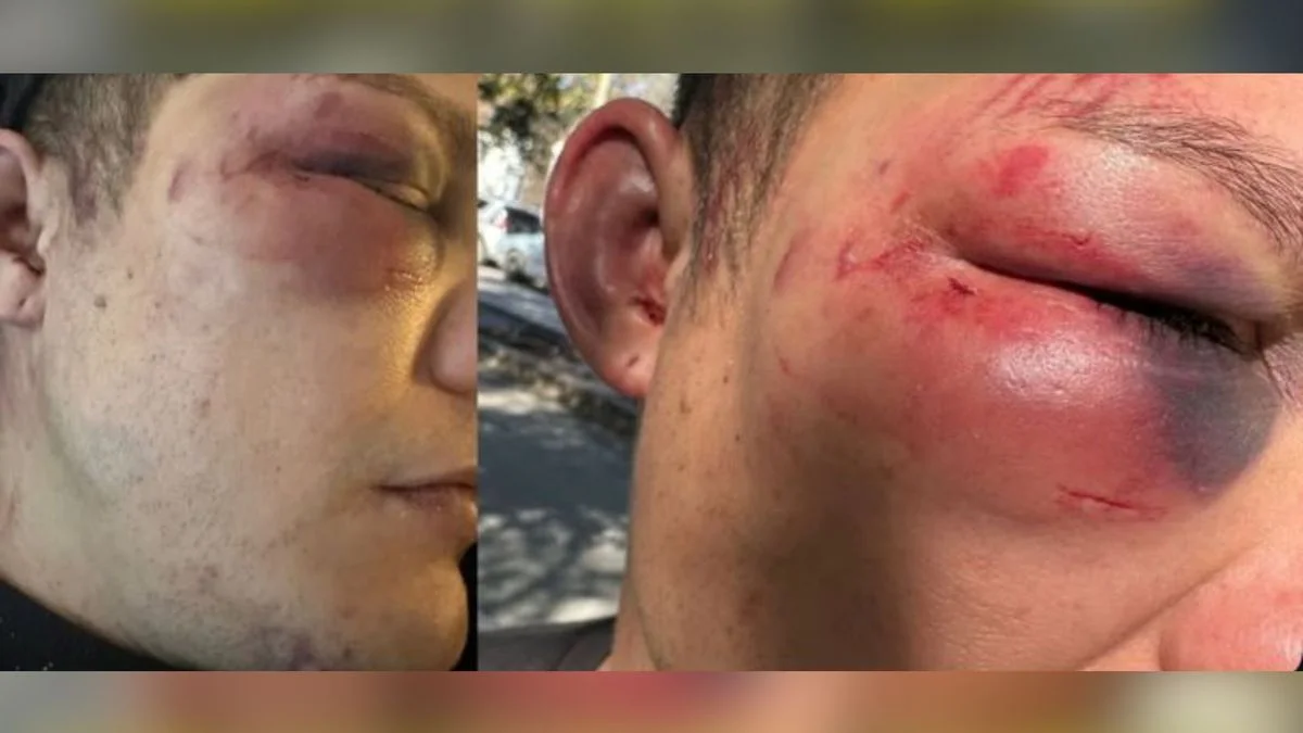 Ataque en manada en La Plata: un joven fue brutalmente golpeado en un boliche