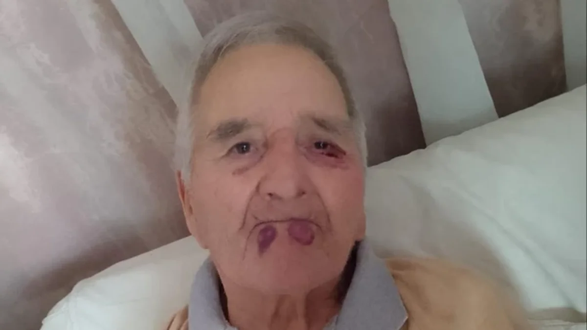 VIDEO: Tiene 89 años y lo golpearon en el geriátrico porque "no quería tomar la medicación"