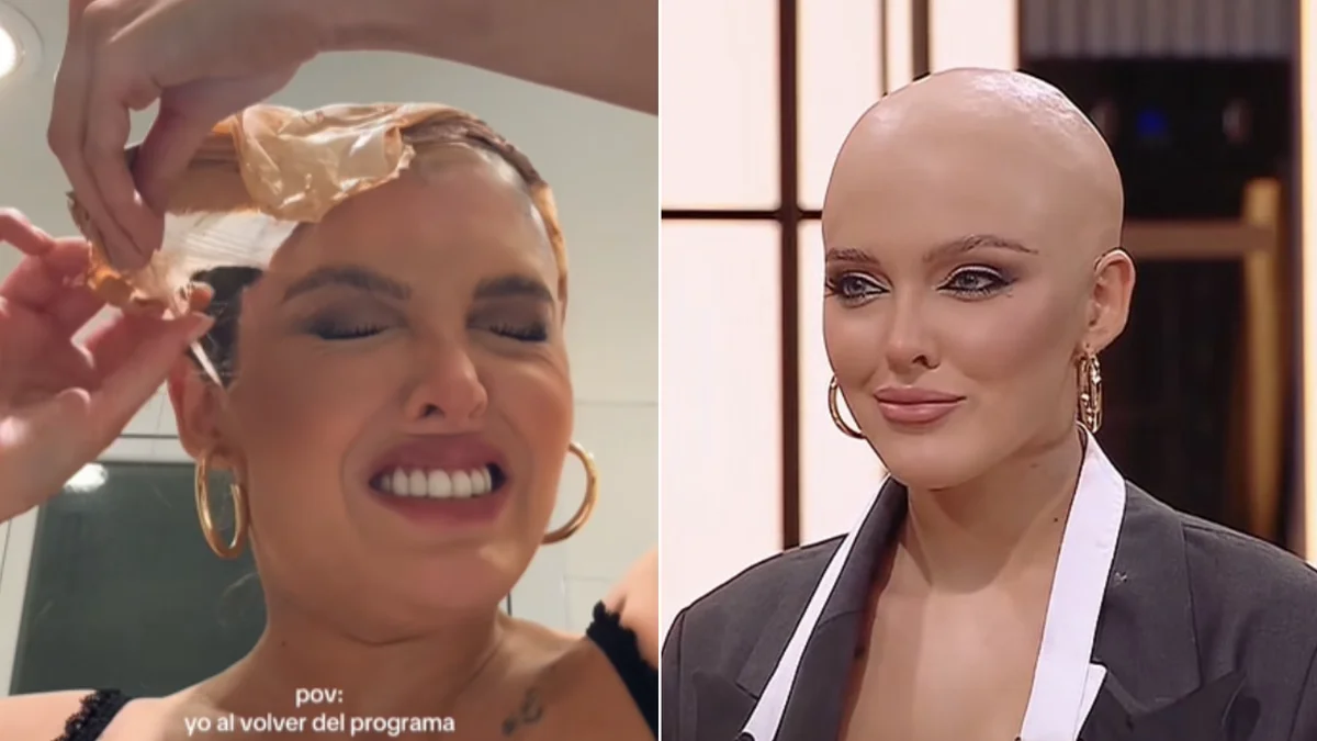 Sofía Gonet mostró el doloroso proceso al que se sometió al terminar Masterchef