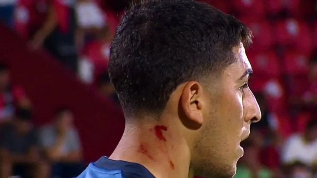 La reacción de Hebe Casado por los incidentes en Newell's-Boca: pidió la misma sanción que recibió Godoy Cruz