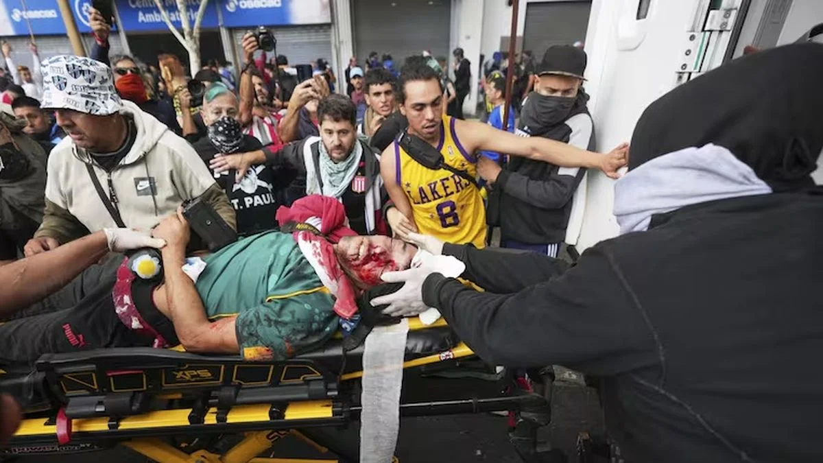 Pelea por su vida un fotógrafo herido en la cabeza en medio de la represión de Bullrich a los jubilados