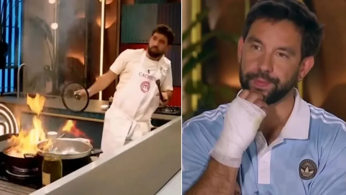 Cachete Sierra sufrió un accidente en Masterchef y su plato terminó en desastre