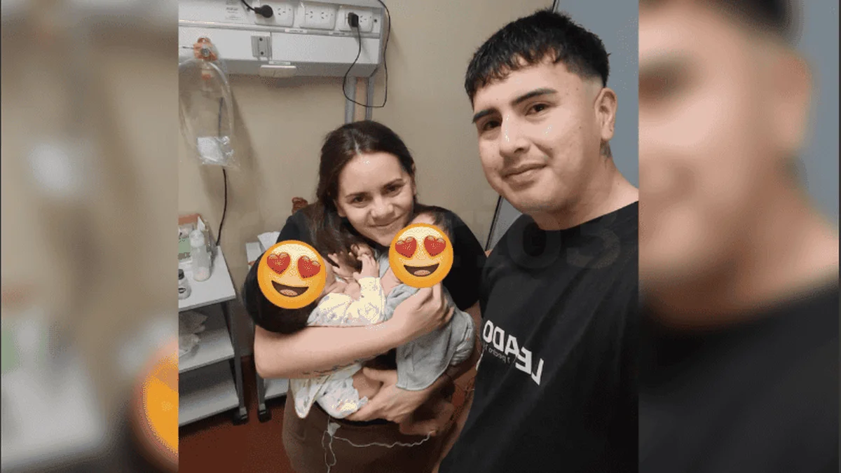 Separaron a dos siamesas en el Hospital Garrahan: "Son dos guerreras que nos llenan de orgullo"