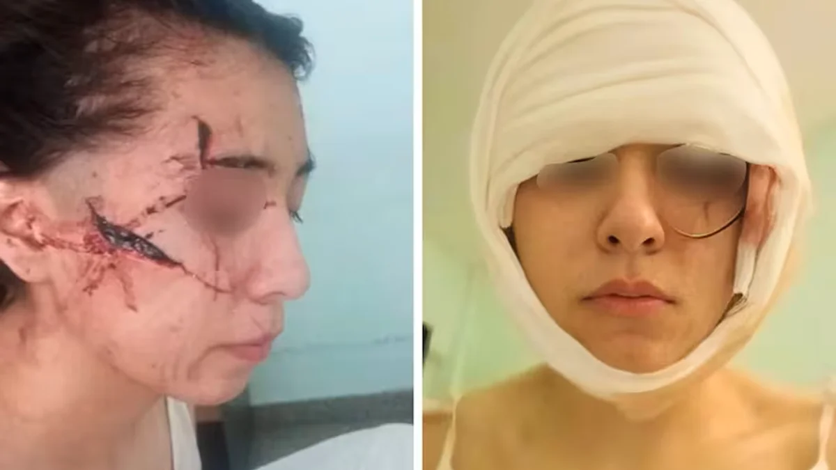 "La querían matar": una menor de 15 años fue atacada por cinco personas y su madre pide justicia