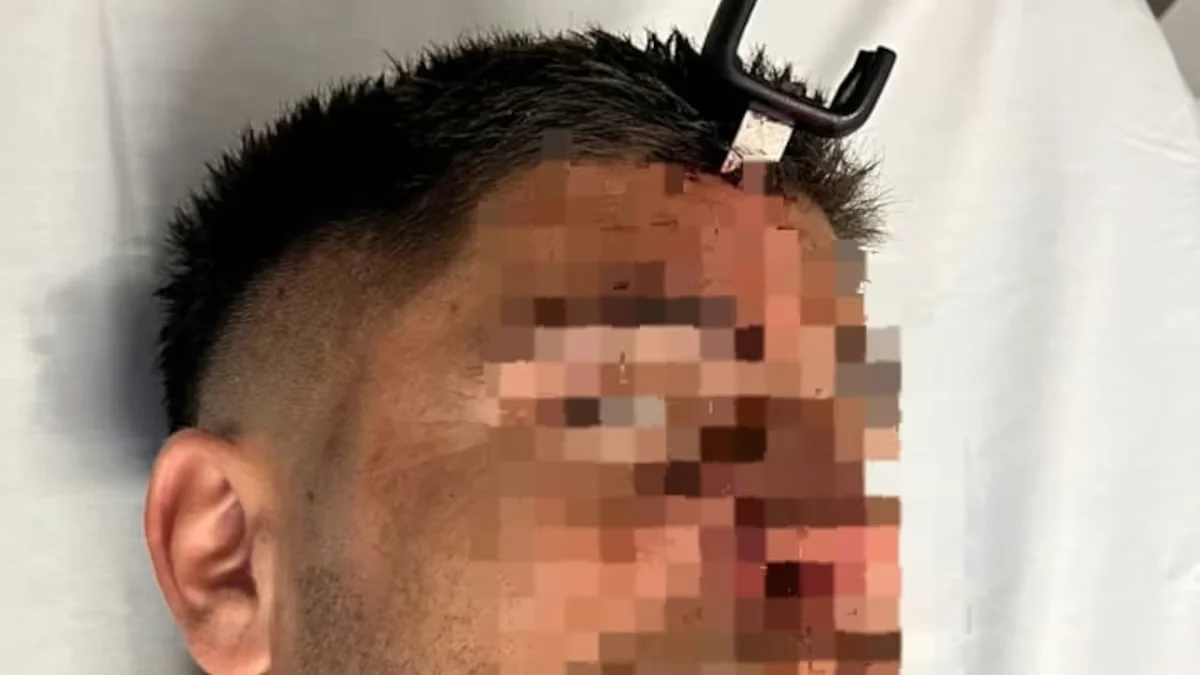 Pelea, disturbios y un futbolista herido: le clavaron una llave en la cabeza tras una batalla campal