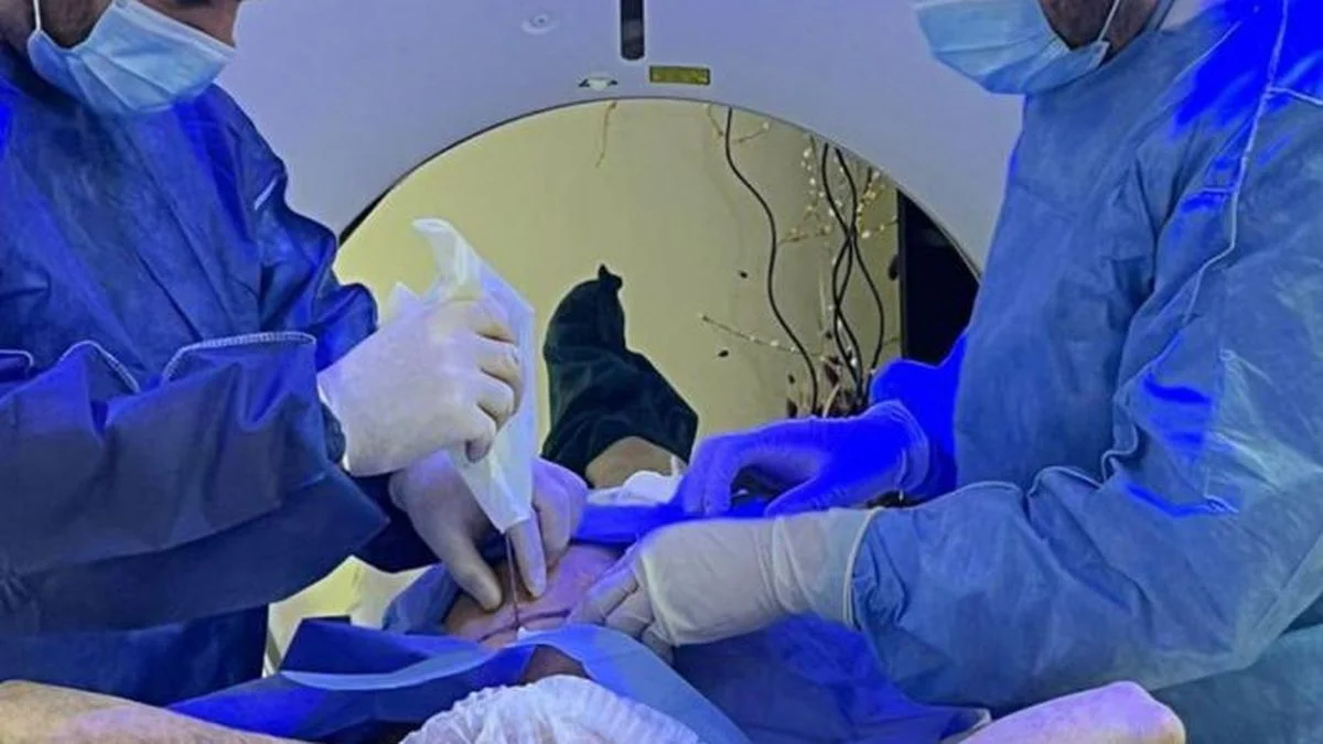 Hito en el hospital de Malargüe: realizaron la primera biopsia pulmonar guiada por tomografía
